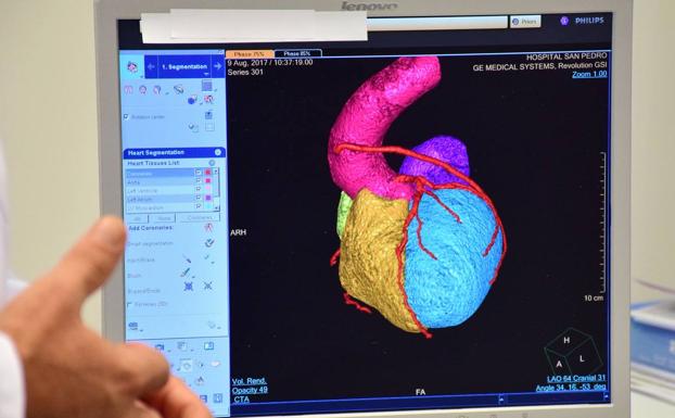 El San Pedro, excelente en cardiología