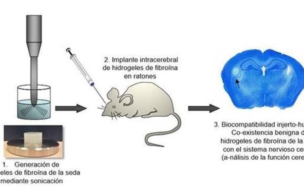 Seda para reparar el cerebro