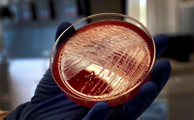 Los últimos focos de listeria fueron alertas «habituales»