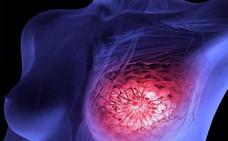 Demuestran la efectividad de la tecnología Protac contra el cáncer de mama
