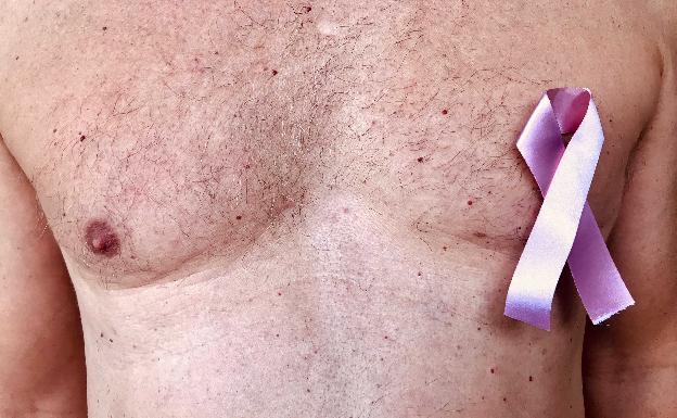 El cáncer de mama, una enfermedad con nombre de mujer que también sufren los hombres