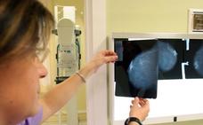 La inteligencia artificial afina el diagnóstico de cáncer de mama