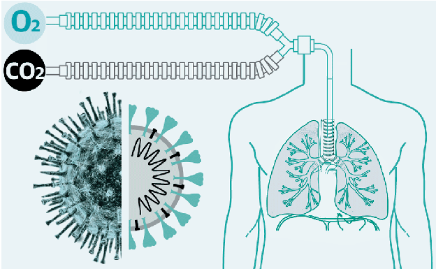 Así funciona un respirador artificial