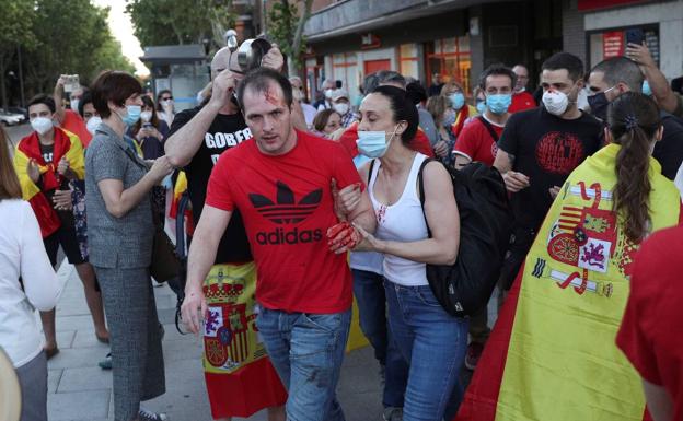 Almeida responsabiliza a los «violentos» de una agresión en una «concentración pacífica» en Madrid