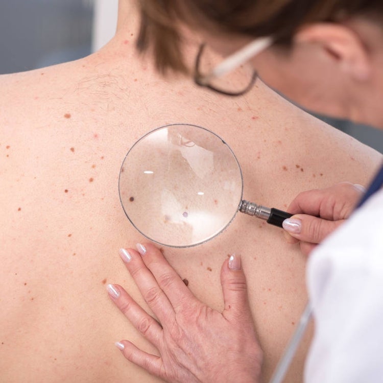 Uno de cada cinco pacientes con cáncer no está siendo diagnosticado