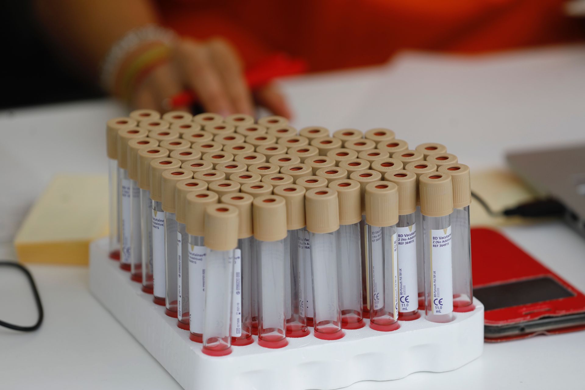 Ligero repunte de los casos activos y la incidencia acumulada en un día sin fallecidos