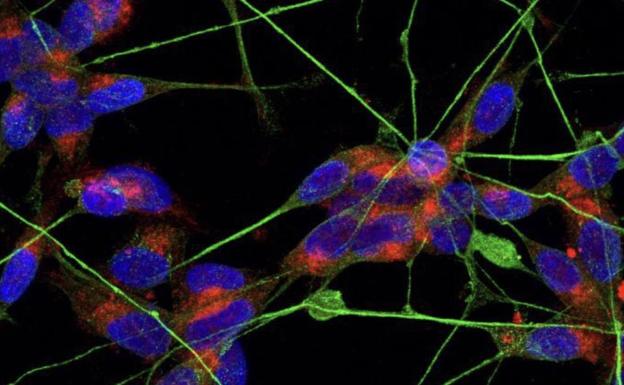 Los astrocitos explican por qué la covid provoca a veces trastornos neuronales