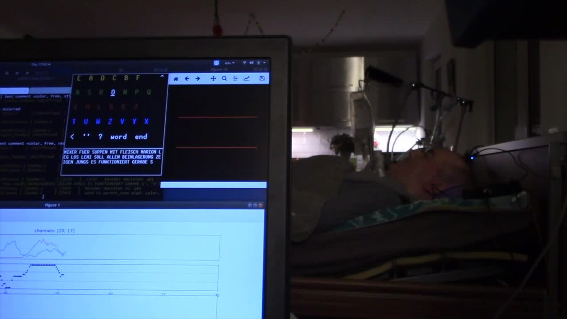 Un paciente de ELA vuelve a comunicarse con un implante neuronal
