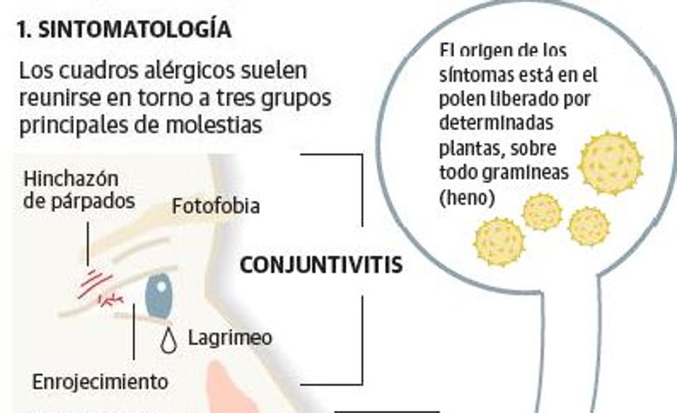 Gráfico: síntomas y tratamiento de las alergias