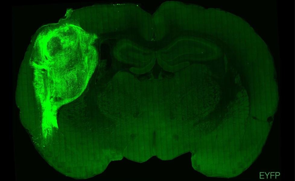 Insertan 'minicerebros' humanos en ratas para investigar enfermedades neurológicas