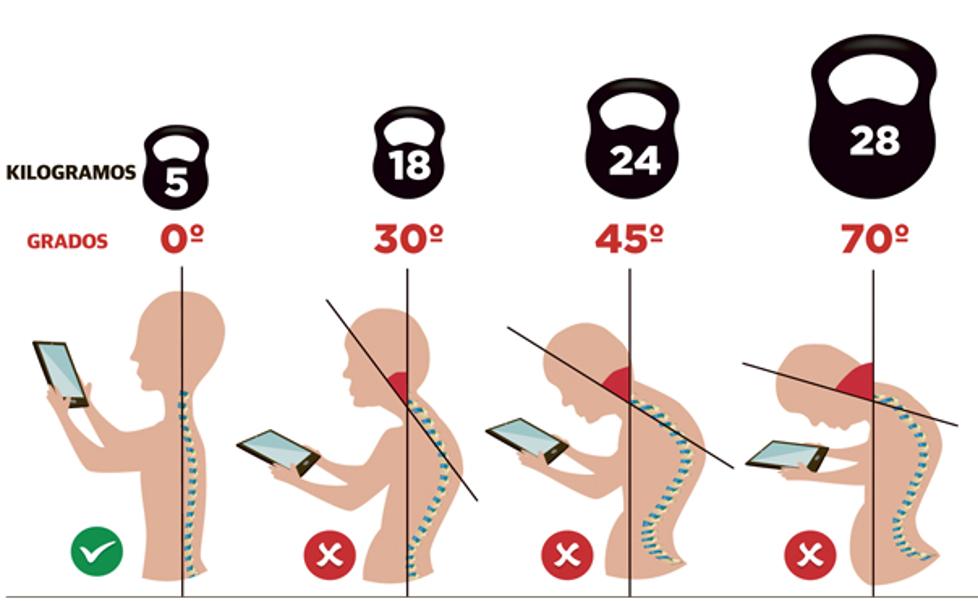 El 'síndrome del cuello roto'