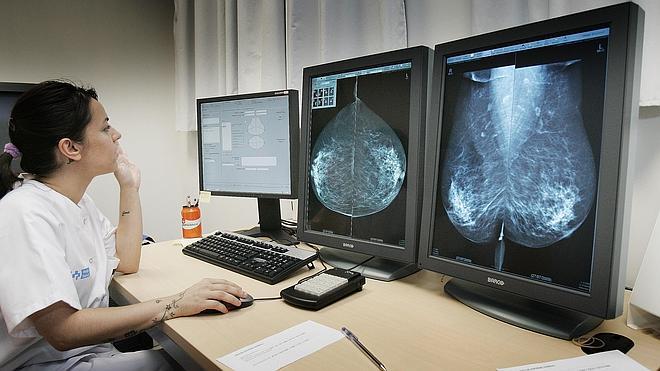 Un nuevo tratamiento aumenta casi en un 40% la supervivencia ante el cáncer mama