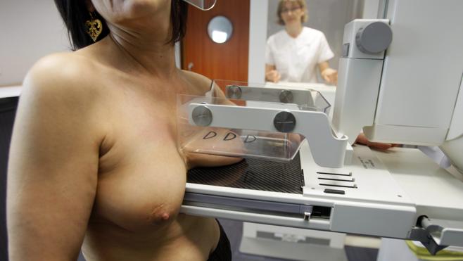 Oncólogos y pacientes ponen en marcha el primer registro a gran escala de cáncer de mama