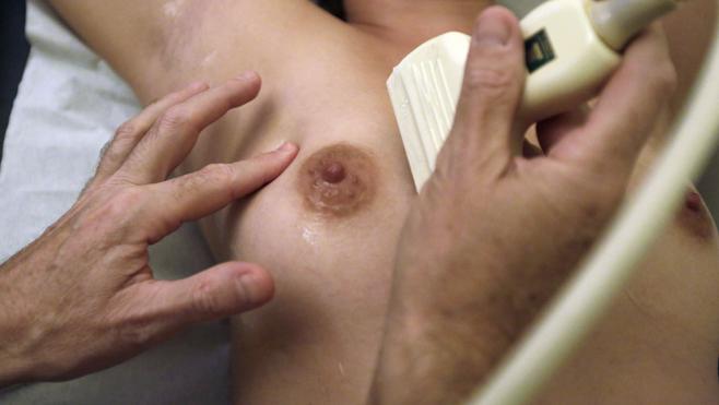 Las mamografías han reducido la mortalidad por cáncer de mama en un 35%
