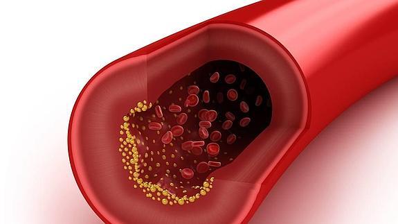 Logroño libra una batalla contra el colesterol